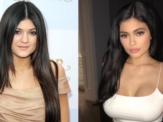Kylie Jenner