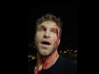 Keegan Allen