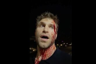 Keegan Allen